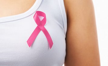 Tumore al seno con mutazione BRCA