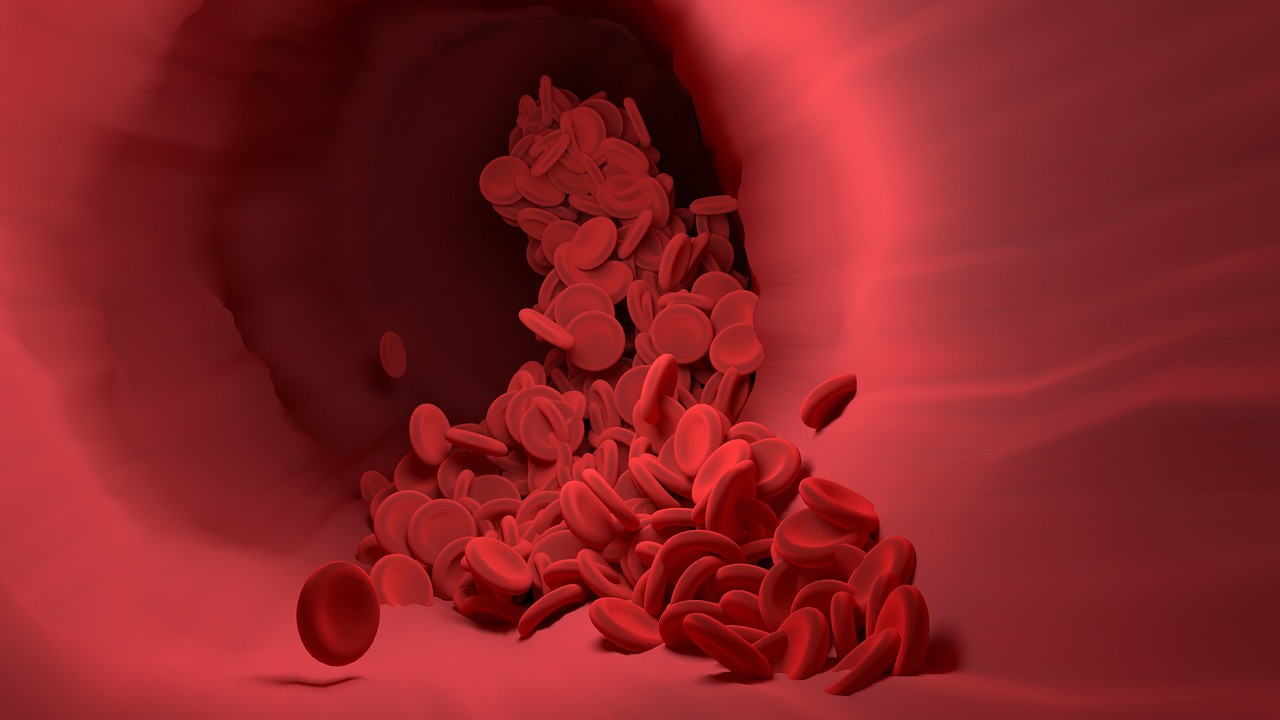 Immagine che illustra i sintomi dell'anemia grave, evidenziando stanchezza e pallore.